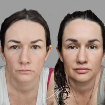 Эльмира Курбанова, Moscow Фото - 9