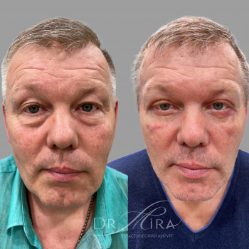 Эльмира Курбанова, Moscow Фото - 10