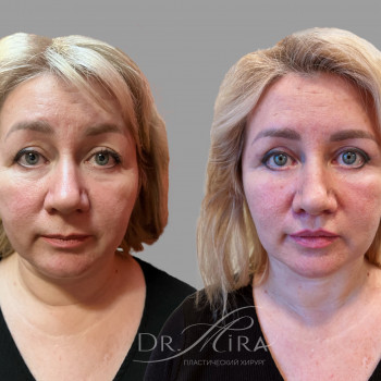 Эльмира Курбанова, Moscow Фото - 13