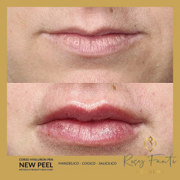 Rosy Fanti, Rome Фото - 5