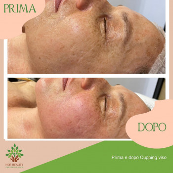 H2B Beauty, Рим Фото - 5