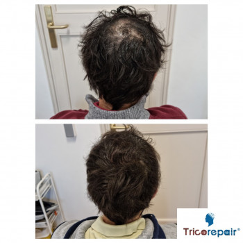 TricoRepair, Rome Фото - 5