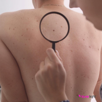 Laserlight, Рим Фото - 5