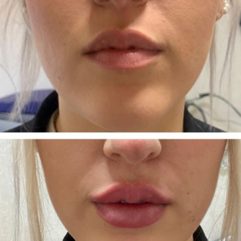 Laserlight, Рим Фото - 6