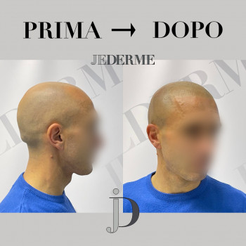 Jederme, Болонья Фото - 5