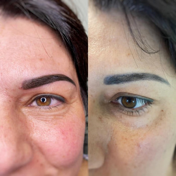 DermaUp, Болонья Фото - 5