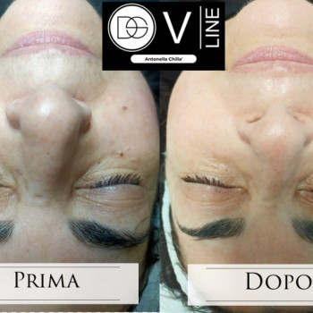 Estetica Giò, Bologna Фото - 5