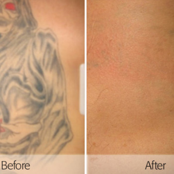 Friedman Dermatology, Jerusalem Фото - 5