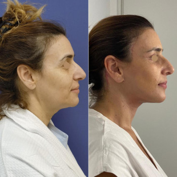 Ella Clinic, Тель-Авив Фото - 5