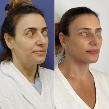 Ella Clinic, Тель-Авив Фото - 6