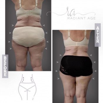 Asya Ravitski, Haifa Фото - 5