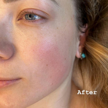 Катя Нес, Хайфа Фото - 5