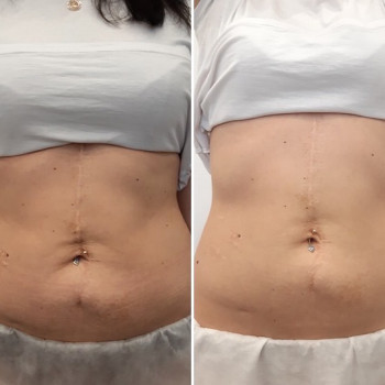 Irena Zolotushko, Haifa Фото - 6