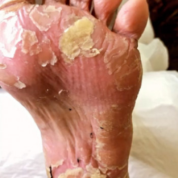 Liliana Valdini, Rishon LeZion Фото - 5