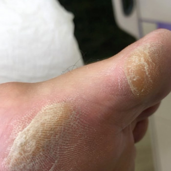 Liliana Valdini, Rishon LeZion Фото - 6