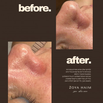 Zoya Haim, Ашдод Фото - 5