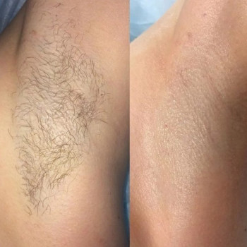 Ксения , Ашдод Фото - 5