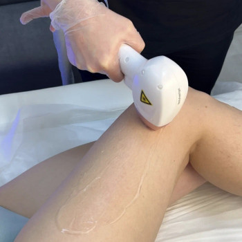 LaserCare, Tolyatti Фото - 16