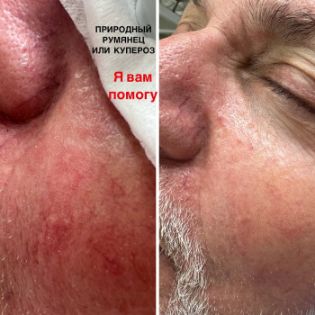 Beauty Touch, Ashdod Фото - 5