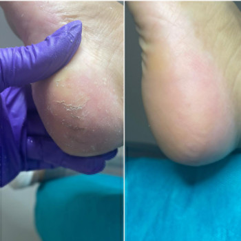 Ирина , Ашдод Фото - 5