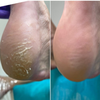 Ирина , Ашдод Фото - 6