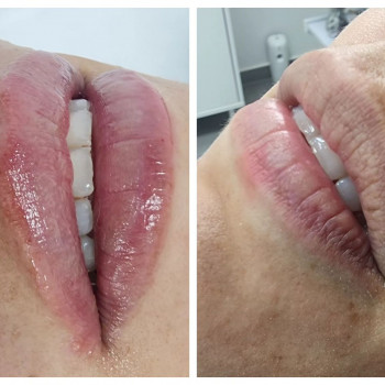 Dr. Brailovski, Беэр-Шева Фото - 5