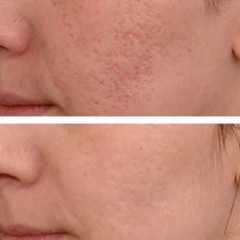 Poletsky Studio, Беэр-Шева Фото - 5