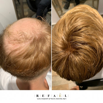 Refael, Беэр-Шева Фото - 5