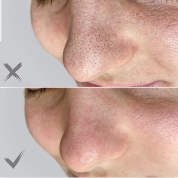 Валентина , Нетания Фото - 6