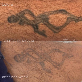 ESELE, Netanya Фото - 5