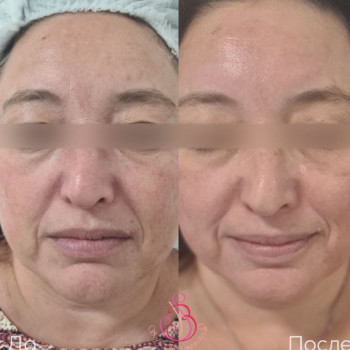 Sofie Bluminshtein, Netanya Фото - 5