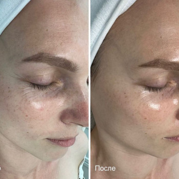 Nataly Shatilo, Netanya Фото - 5