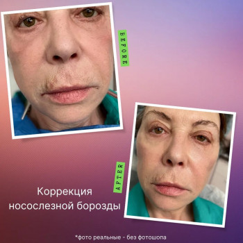 Lana Emeliyanov, Netanya Фото - 5