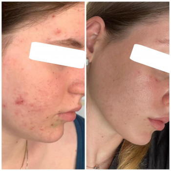 Ирина Дубинская, Рамат-Ган Фото - 5