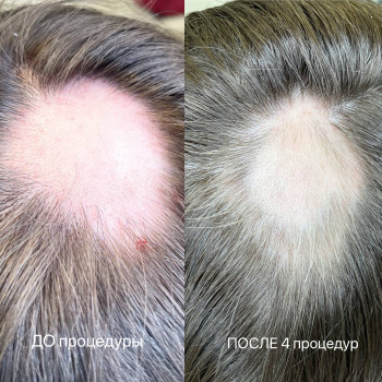 Olena Cherepova, Wrocław Фото - 7