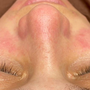 Уходовые процедуры: чистки, пилинги
                    Студия эпиляции, коррекции фигуры и косметологии  Toplaser Pro Moscow Moscow