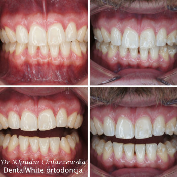 Dental White, Warszawa Фото - 5