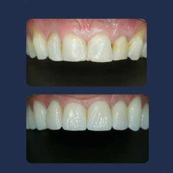 Boutique Dental, Варшава Фото - 5