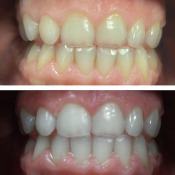 DentaLook, Варшава Фото - 5