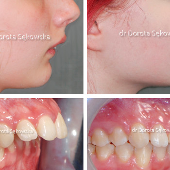 DentaLux, Warszawa Фото - 5