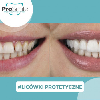 ProSmile, Warszawa Фото - 5