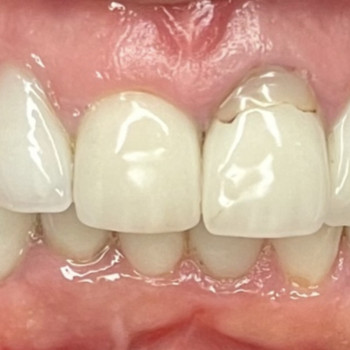 Bartosz Mulawa, Warsaw Фото - 5