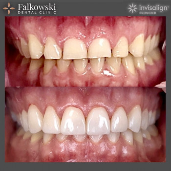 Falkowski, Warszawa Фото - 5