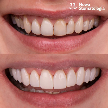 32, Kraków Фото - 5