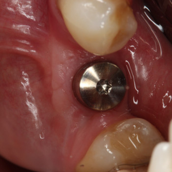 Диагностика зубов