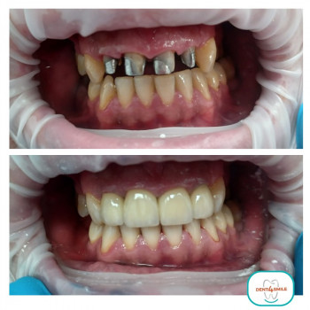 Dent4Smile, Вроцлав Фото - 5