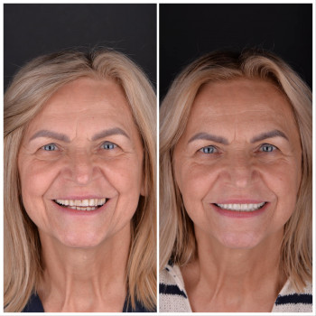 Esthetic Dental Studio, Gdańsk Фото - 5