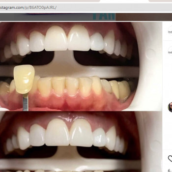 Anna Dvolitko, Lodz Фото - 5