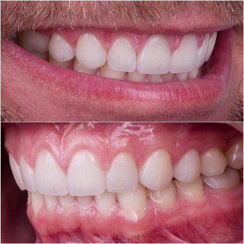 Aliaksei Charniuk, Poznan Фото - 5