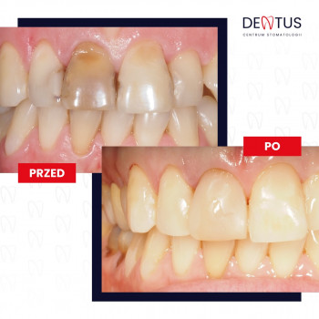 Dentus, Bydgoszcz Фото - 5